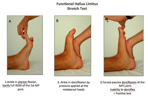 Best Walking Shoes for Hallux Rigidus & Limitus 2 Best Walking Shoes for Hallux Rigidus & Limitus 2